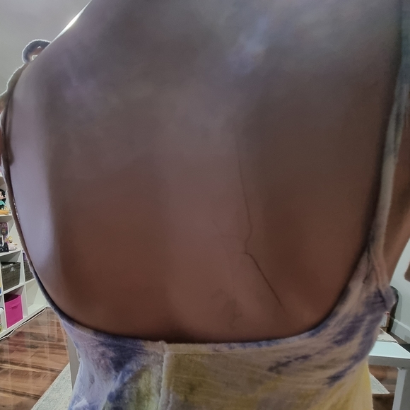 🤩Billabong summer dress☀️ - Picture 8 of 10